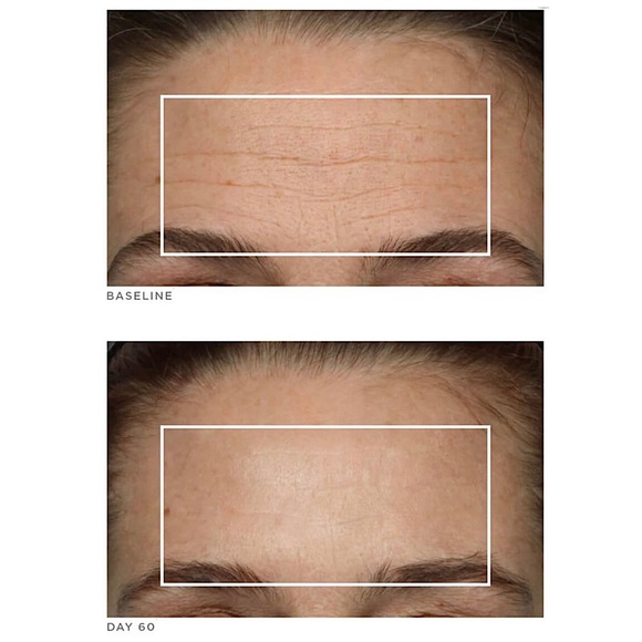 NUFACE TRINITY COMPLETE FACIAL TONING KIT - Picture 11 of 12